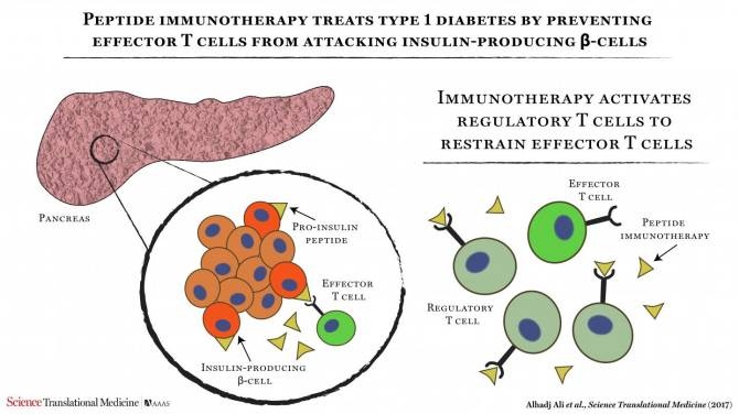 Se demuestra la seguridad de la inmunoterapia para la diabetes